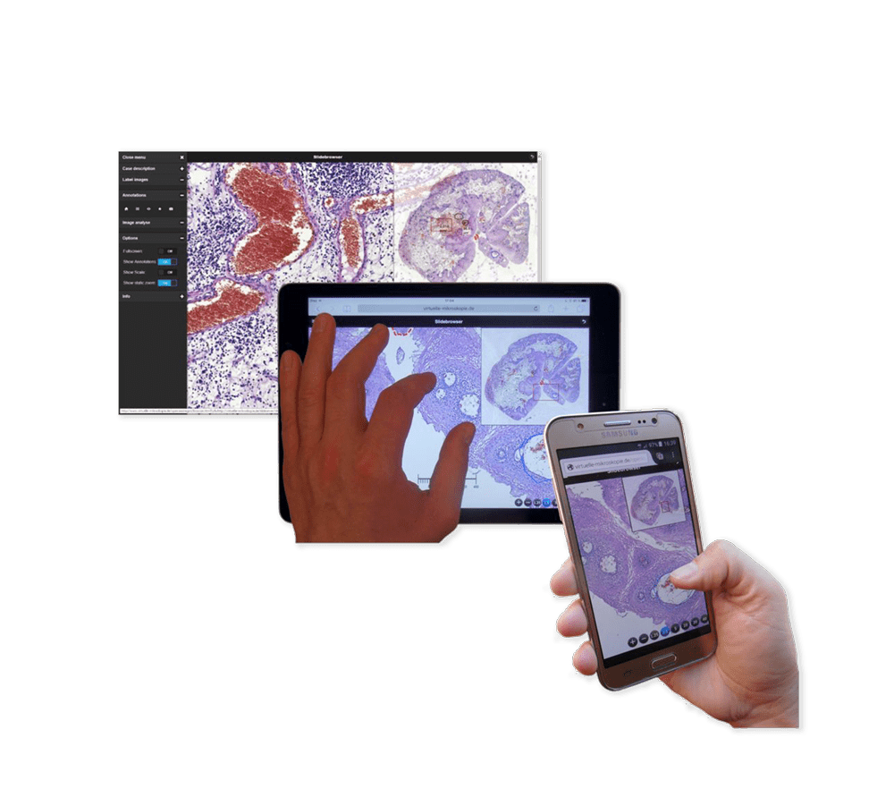 Digital Slide Suite Image VMscope